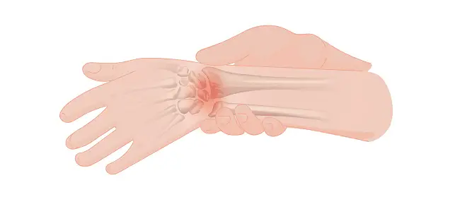wrist pain image